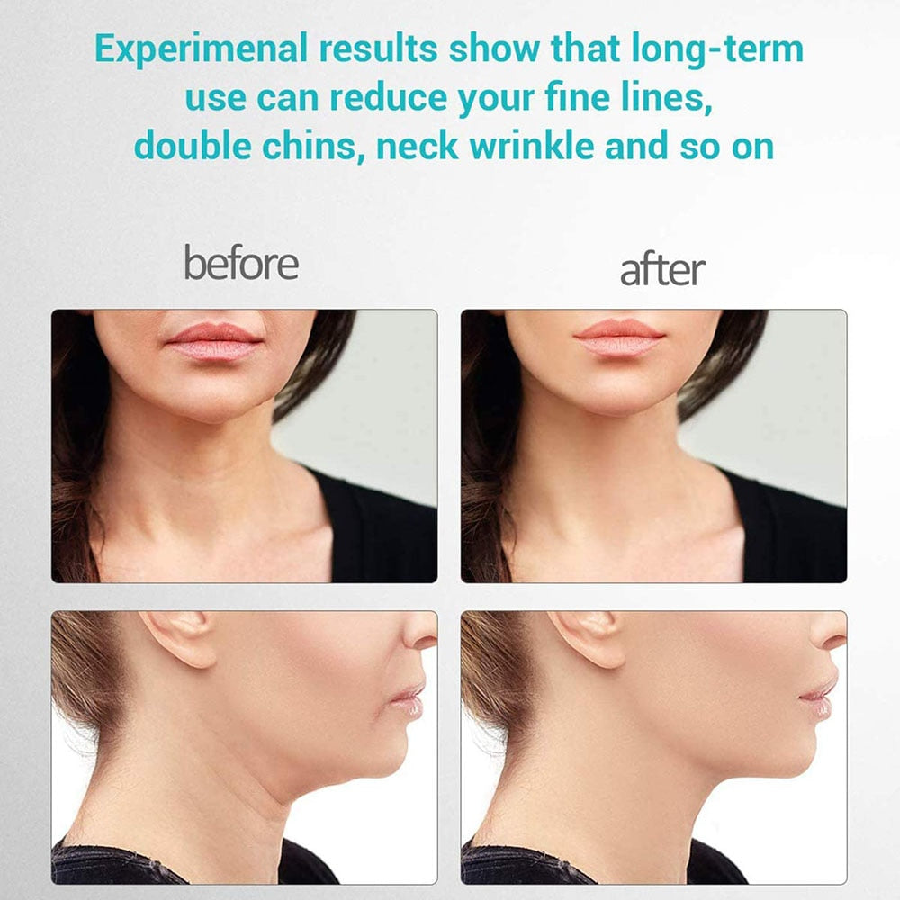 SkinTopia Anti-Aging & Anti-Wrinkle Device